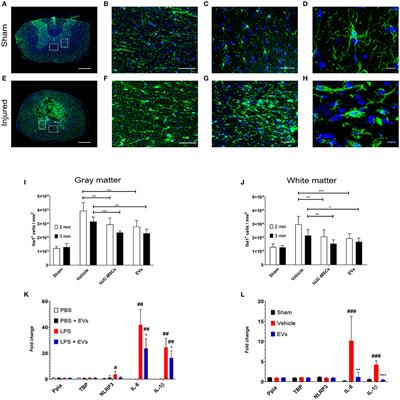 Extracellular Vesicles Can Deliver Anti-inflammatory and Anti-scarring Activities of Mesenchymal Stromal Cells After Spinal Cord Injury